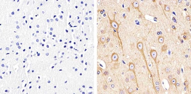 Alpha Tubulin Antibody (clone TU-01)