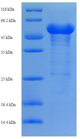 Human KATII / AADAT Protein (Recombinant His-SUMO)