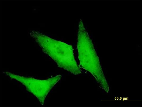 HSPB1 / HSP27 Antibody (clone 3G3)