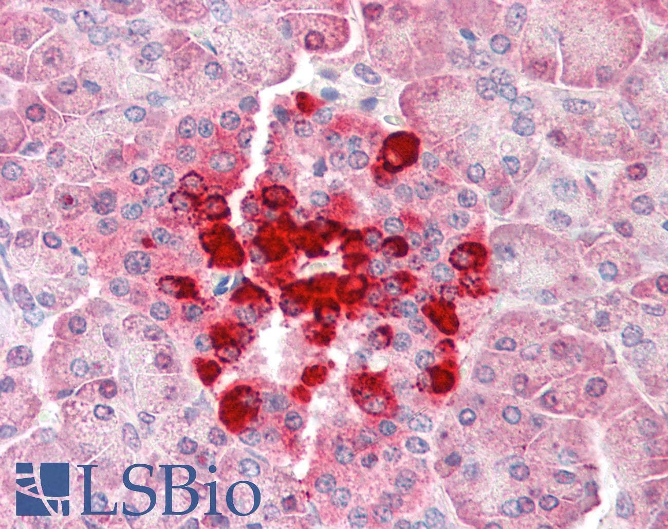 IHC-plus™ Polyclonal Rabbit anti-Human CFLAR / FLIP Antibody (IHC, IF, WB)
