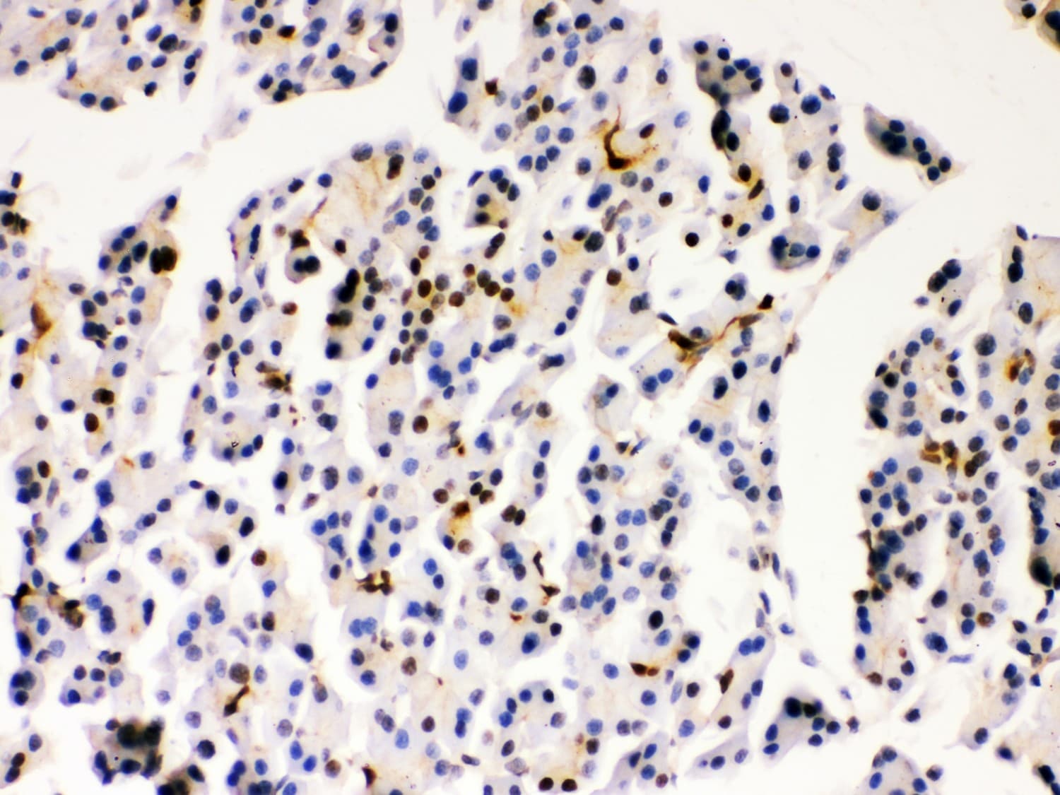 PARK7 / DJ-1 Antibody (aa2-189)