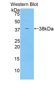 ANGPTL7 / CDT6 Antibody (aa22-337, APC)