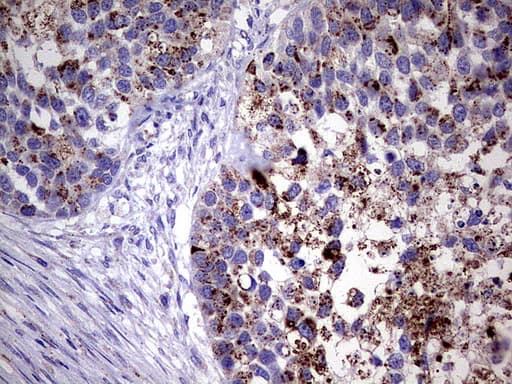 GBA / Glucosidase Beta Acid Antibody (aa40-315, clone UMAB171)