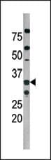 CDK2 Antibody (phospho-Thr160)