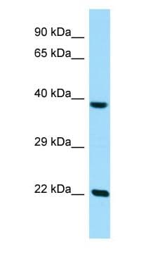 Polyclonal Rabbit anti-Human CLPP Antibody (aa196-245, WB)