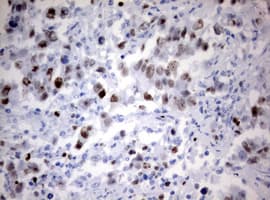 Monoclonal Mouse anti-Human MKI67 / Ki67 Antibody (clone OTI5E4, aa1160-1493, IHC)