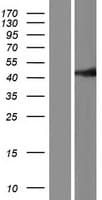 Human TP53 / p53 Protein (Over-Expression Lysate Myc-DDK (Flag))