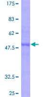 Human ZCCHC10 Protein (Recombinant GST)