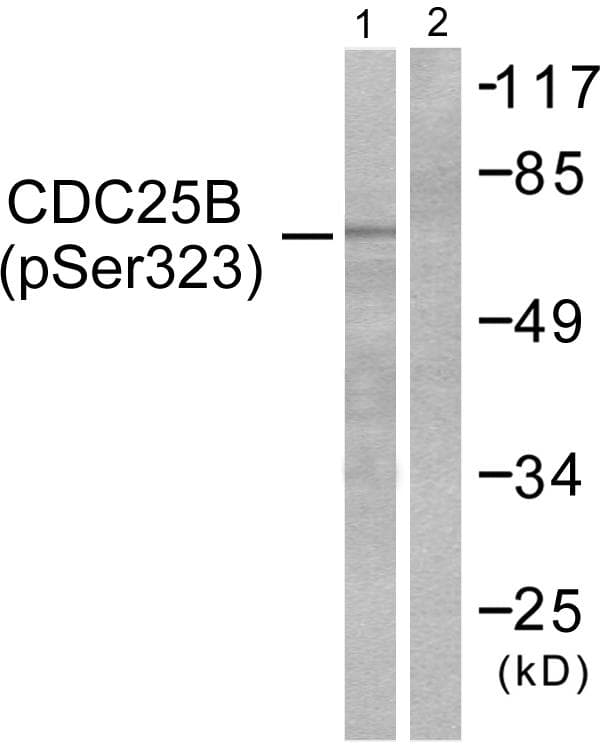 CDC25B Antibody (phospho-Ser323)