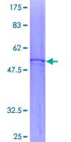 Human SLC25A4 / ANT Protein (Recombinant GST)