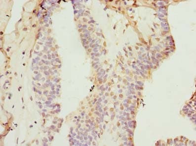 KEL / CD238 Antibody