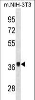 FGF8 Antibody (aa30-59)