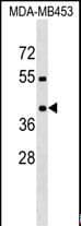 Polyclonal Rabbit anti-Human PRRT2 Antibody (aa207-233, WB)