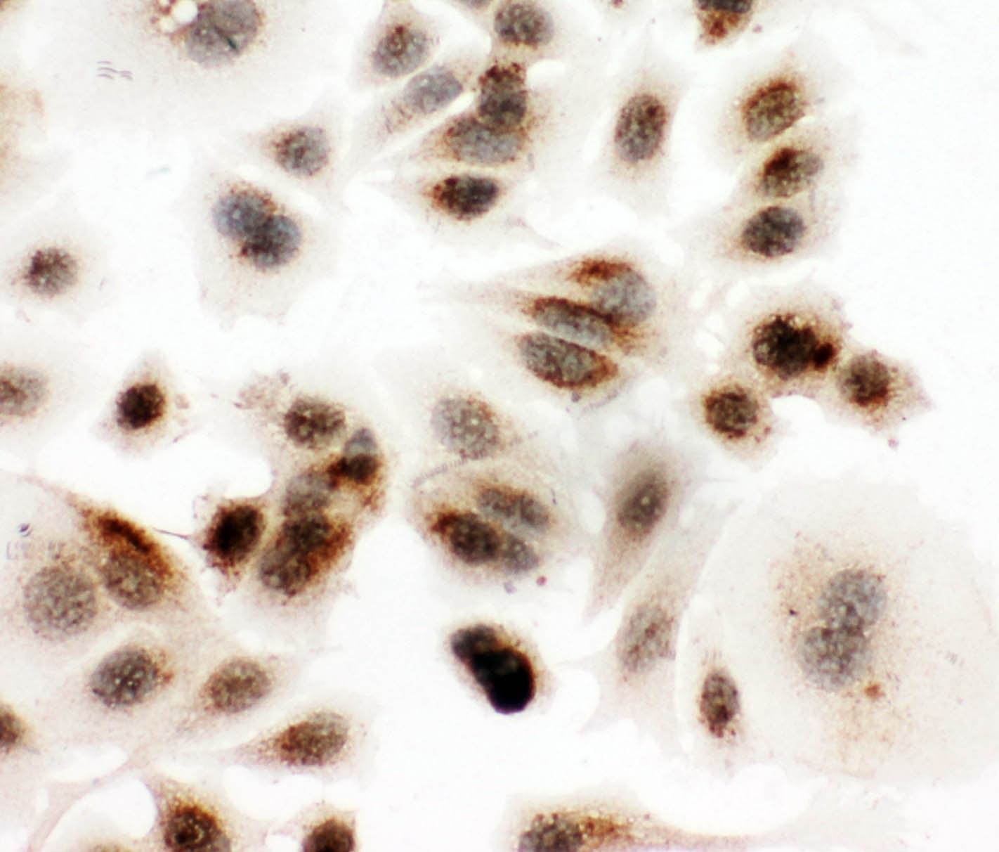 DDX4 / VASA Antibody (aa253-272)