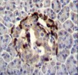 STXBP3 Antibody (aa145-171)