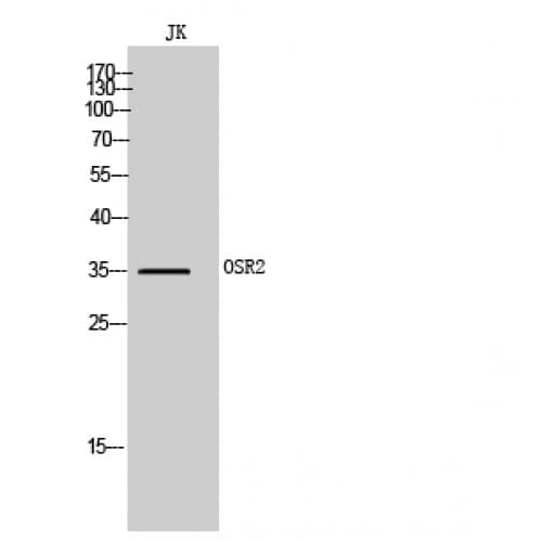 OSR2 Antibody (60-140 aa, Internal)