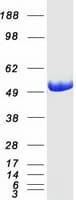 Human ADSL / Adenylosuccinate Lyase Protein (Recombinant Myc-DDK (Flag))