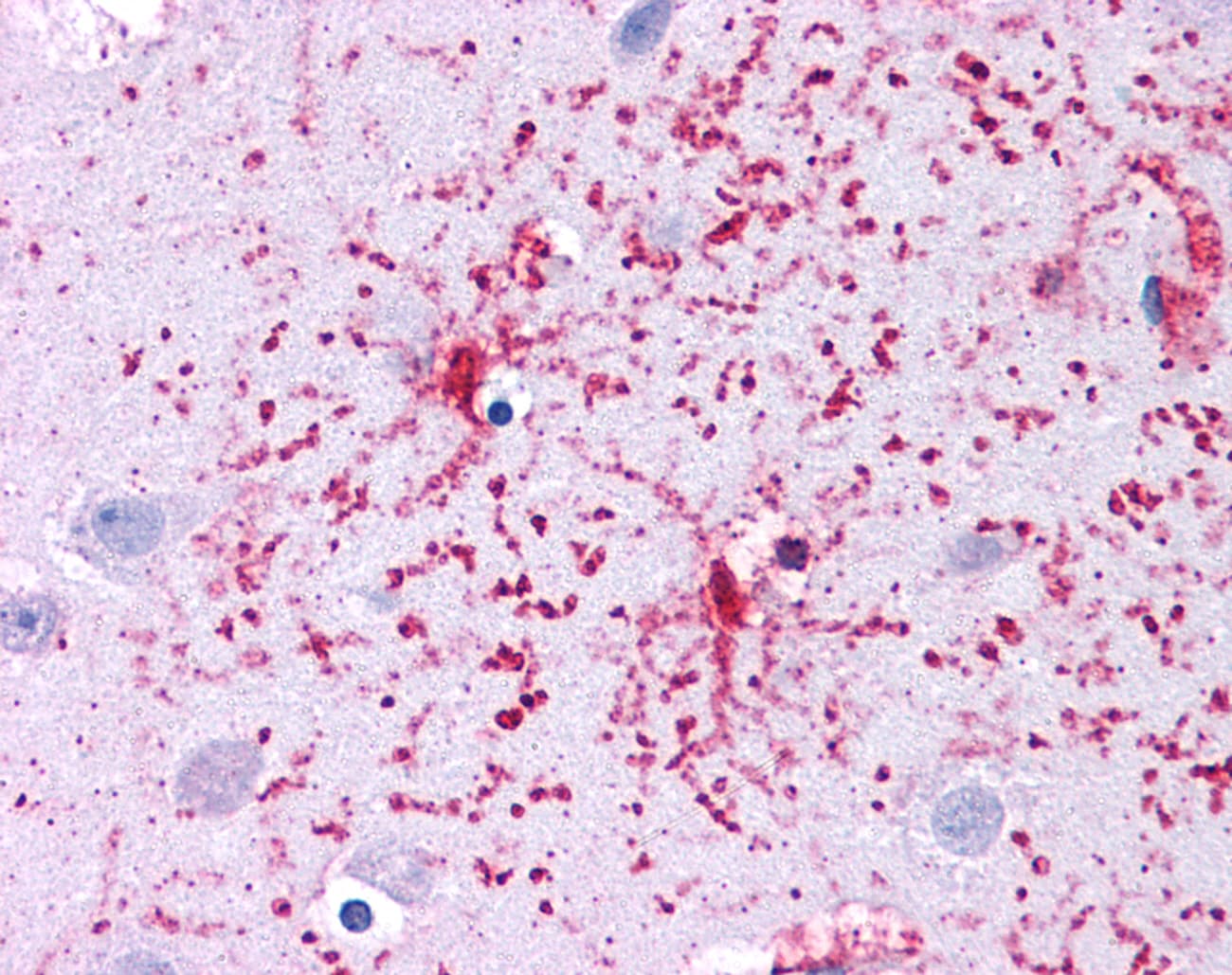 GLUD1/Glutamate Dehydrogenase Antibody (aa182-231)