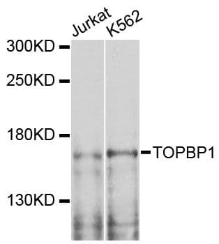 TOPBP1 Antibody