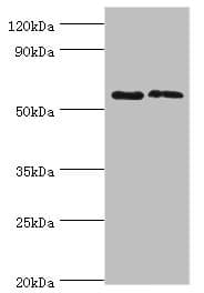 PLAP / Alkaline Phosphatase Antibody (aa260-520)