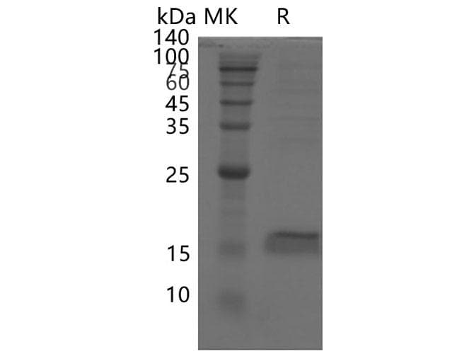 Coronavirus SARS-CoV-2 ORF7a Protein (Recombinant His, N-terminus)