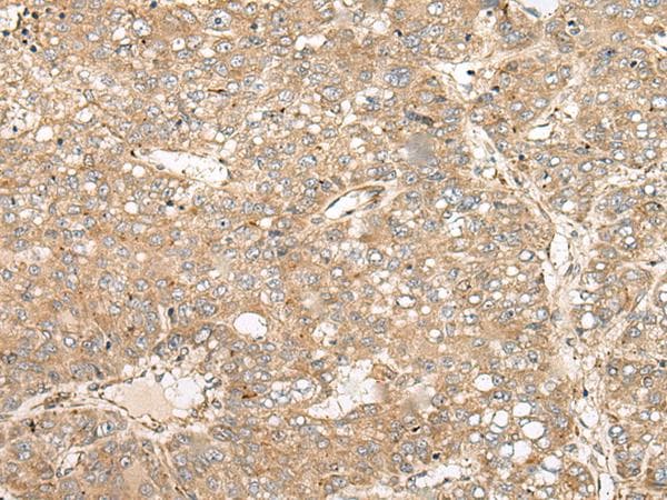 COA7 / SELRC1 Antibody