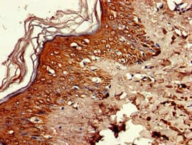 Polyclonal Rabbit anti-Human RNASEH2C / AGS3 Antibody (IHC, IF, WB)