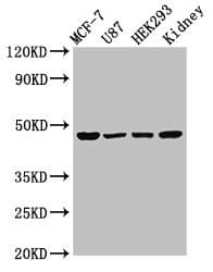 Polyclonal Rabbit anti-Human WWOX Antibody (IHC, WB)
