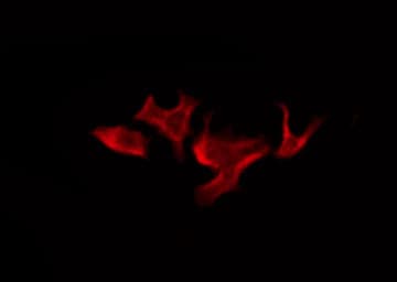 OR52B2 Antibody
