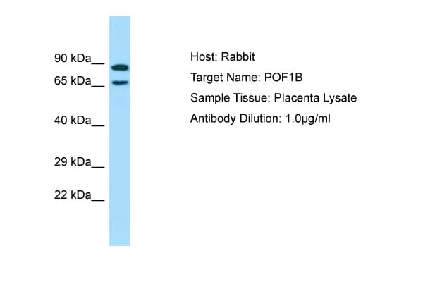 POF1B Antibody (aa469-518)
