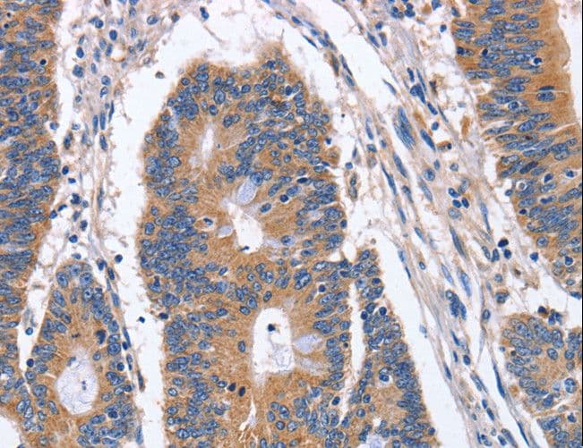 BMP6 Antibody