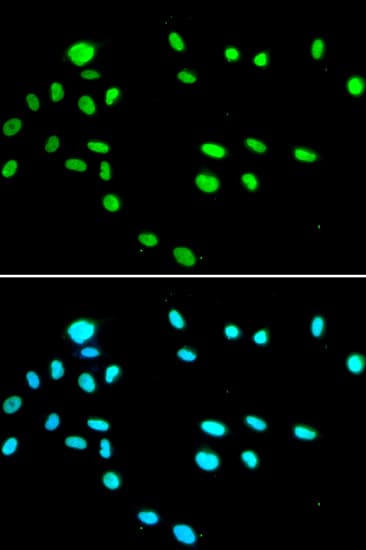 TIP49 / RUVBL1 Antibody