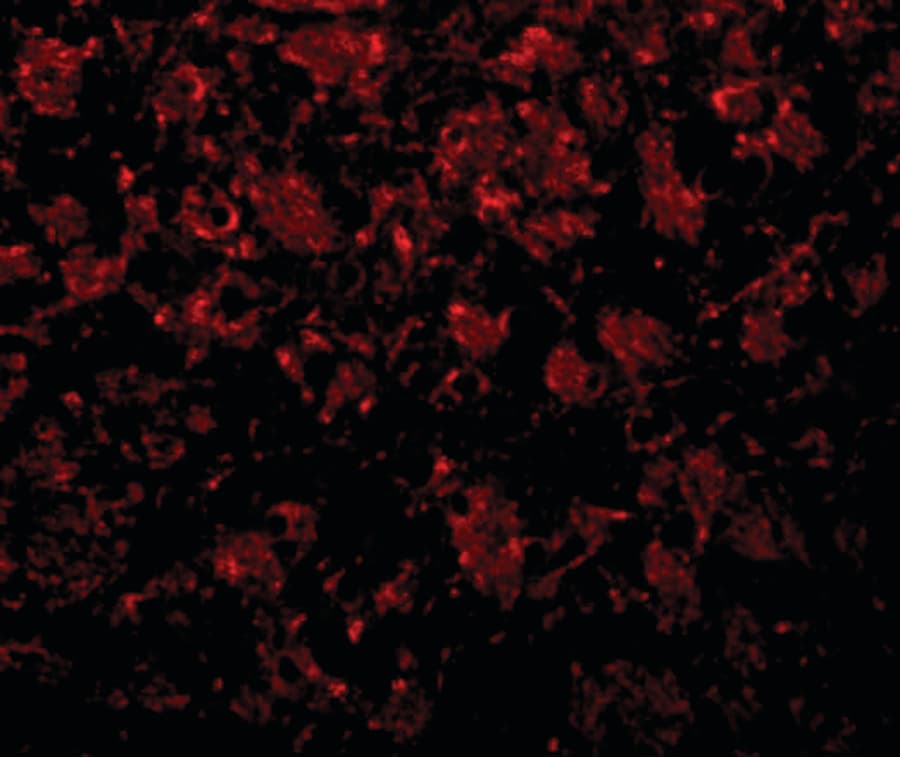 IHC-plus™ GOLM1 / GP73 / GOLPH2 Antibody