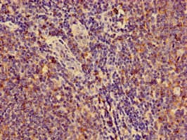 HLA-C Antibody