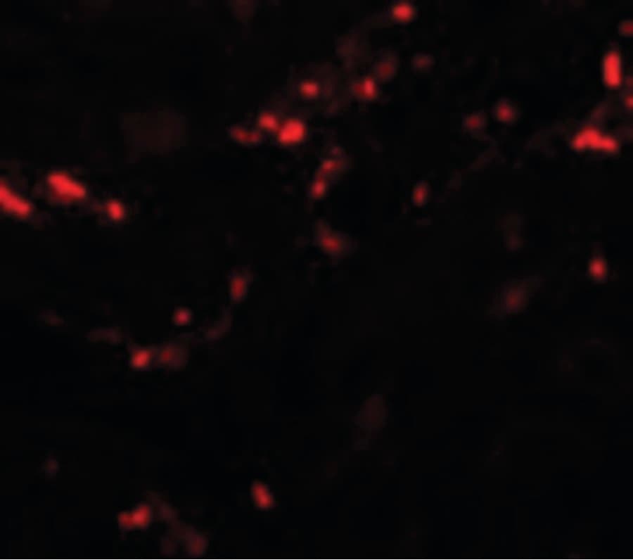 Polyclonal Rabbit anti-Human TCTN1 Antibody (IHC, IF, WB)