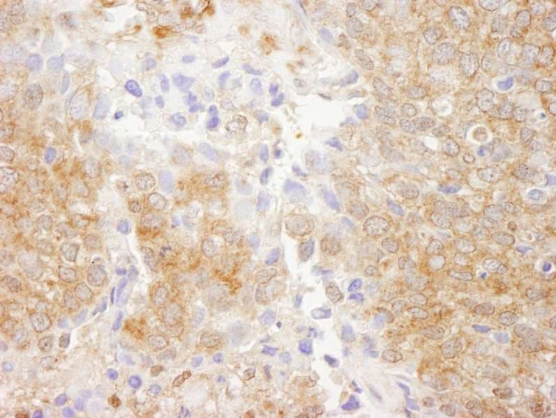 Polyclonal Rabbit anti-Human PTEN Antibody (C-Terminus, IHC, IF, WB)