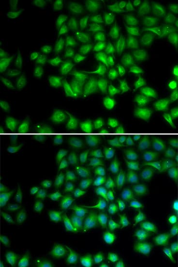 Polyclonal Rabbit anti-Human TRPM2 Antibody (IHC, IF, WB)