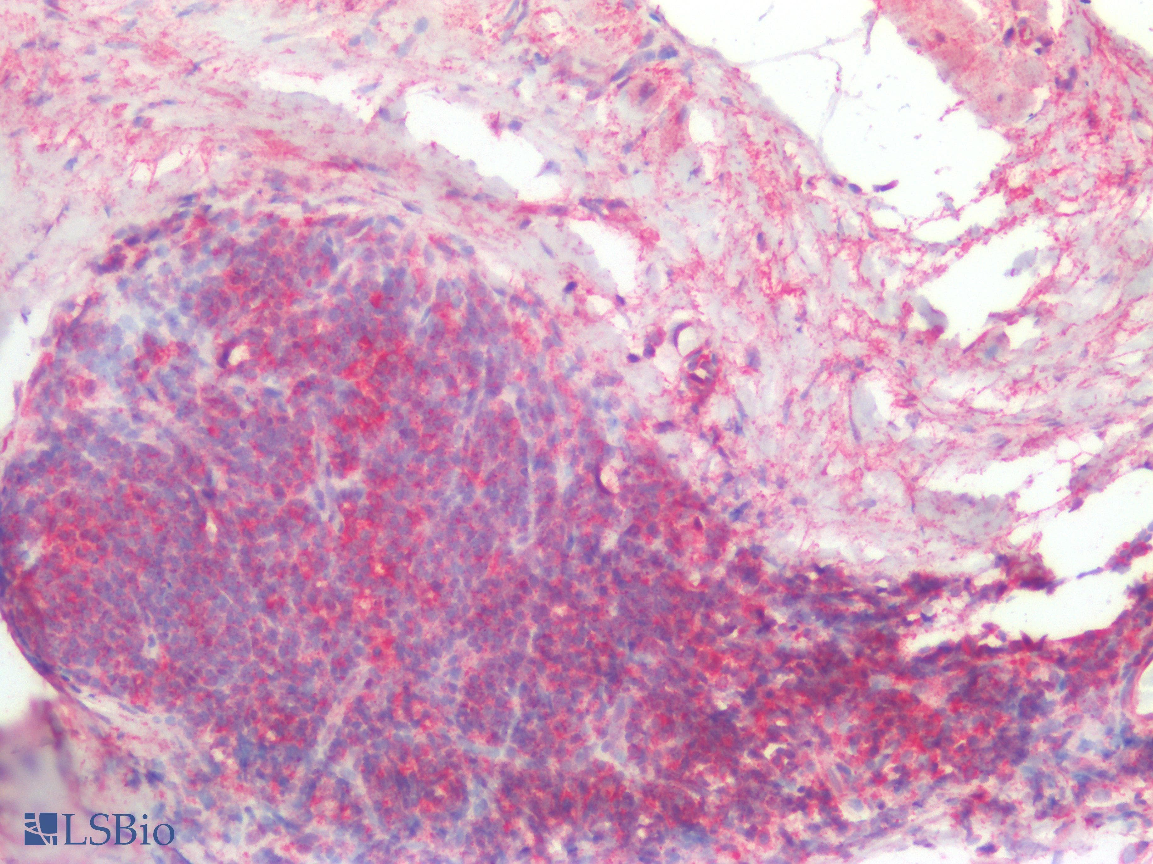 IHC-plus™ TP53 / p53 Antibody