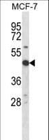 RPS6KB2 / S6K2 Antibody (aa318-346)