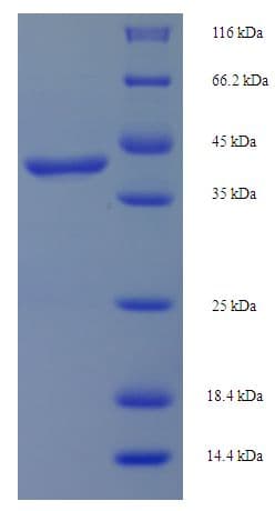 Human DGKG Protein (Recombinant His-SUMO)