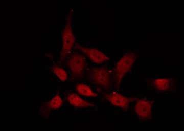 Polyclonal Rabbit anti-Human PRKCD / PKC-Delta Antibody (phospho-Ser645, IHC, IF, WB)