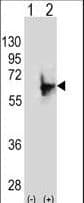 NMT2 Antibody (aa16-46)