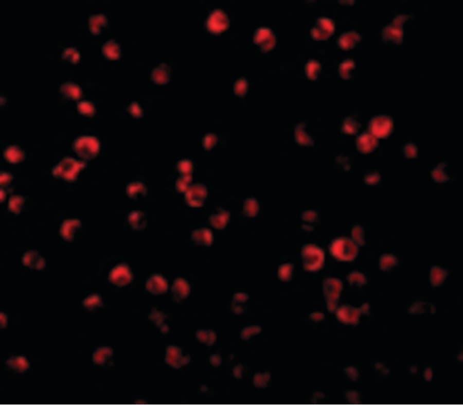 IHC-plus™ Polyclonal Rabbit anti-Human IRS1 Antibody (IHC, IF, WB)