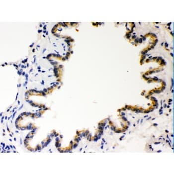 COMT Antibody (aa52-271)