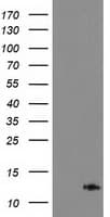 PDE6G / PDE6 Gamma Antibody (clone OTI1H7)