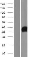 IYD Protein (Over-Expression Lysate Myc-DDK (Flag))