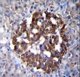 PCDH20 Antibody (aa445-472)