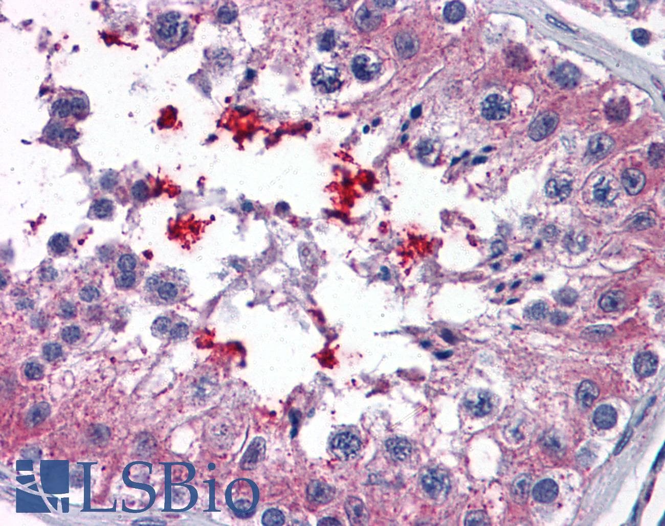 IHC-plus™ ABCD4 Antibody (aa136-149)