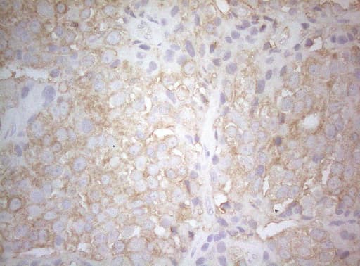 TWF1 / PTK9 Antibody (aa140-384, clone OTI5C12, Carrier-free)