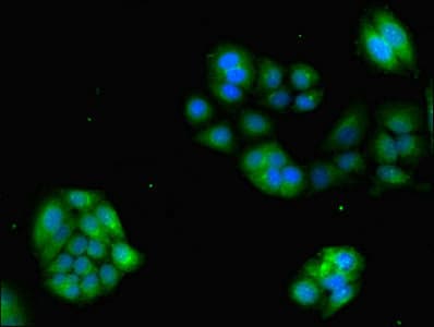 GRK4 Antibody (aa1-245)